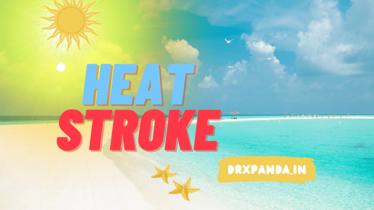 Heat stroke, also known as sunstroke, is a serious condition characterized by the body's inability to regulate its temperature.